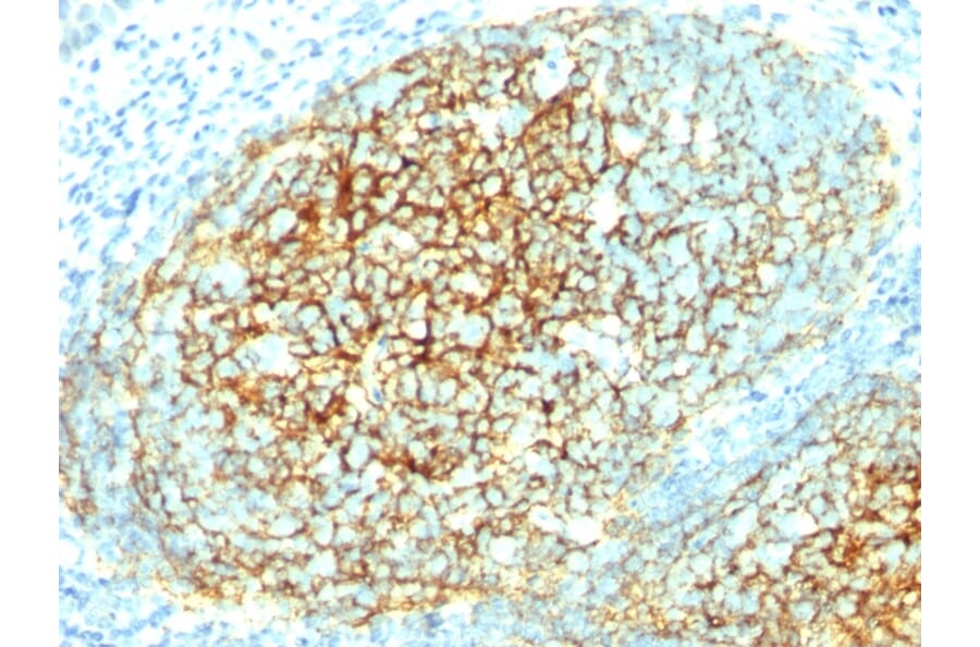 Immunohistochemistry - Anti-VCAM1 Antibody [1.4C3] (A250283) - Antibodies.com