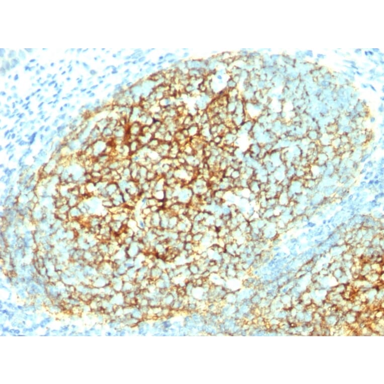Immunohistochemistry - Anti-VCAM1 Antibody [1.4C3] (A250283) - Antibodies.com