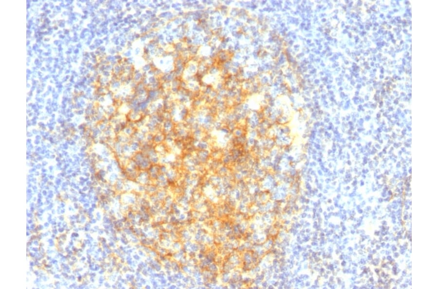 Immunohistochemistry - Anti-VCAM1 Antibody [VCAM1/843] (A250284) - Antibodies.com