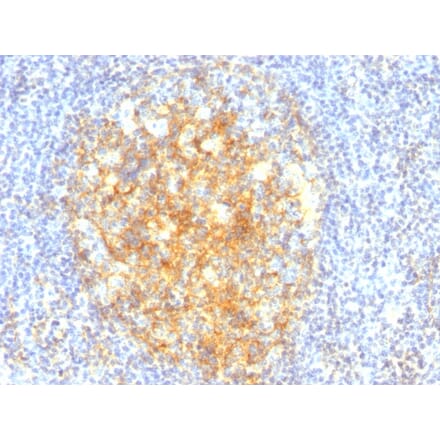Immunohistochemistry - Anti-VCAM1 Antibody [VCAM1/843] (A250284) - Antibodies.com