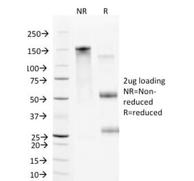 SDS-PAGE - Anti-VCAM1 Antibody [B-K9] (A250285) - Antibodies.com