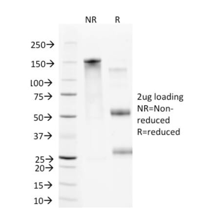 SDS-PAGE - Anti-VCAM1 Antibody [B-K9] (A250285) - Antibodies.com