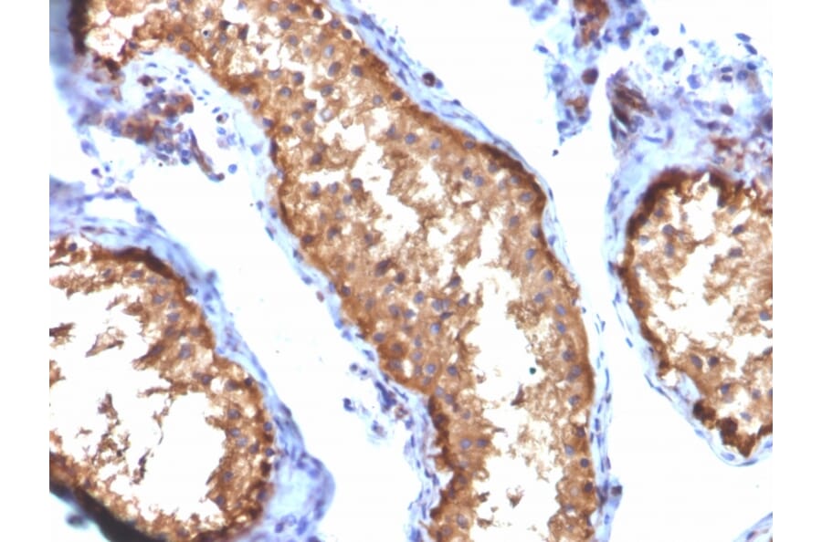 Immunohistochemistry - Anti-Vinculin Antibody [VCL/2572] (A250288) - Antibodies.com