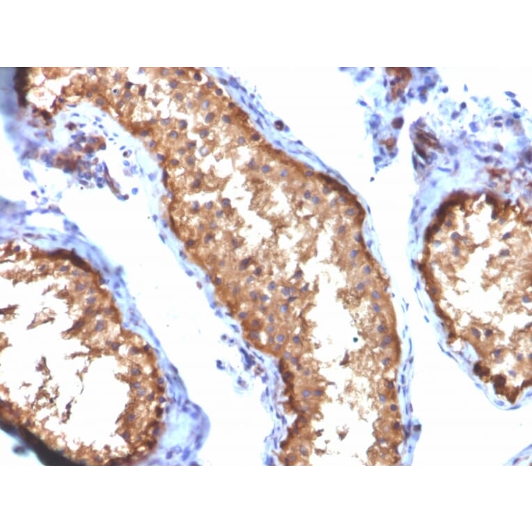 Immunohistochemistry - Anti-Vinculin Antibody [VCL/2572] (A250288) - Antibodies.com