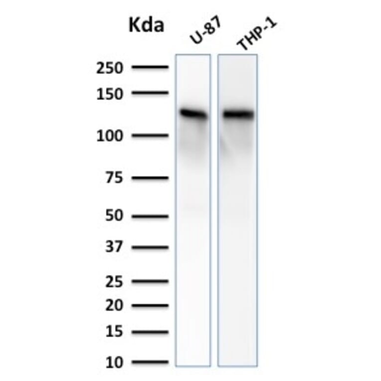 Western Blot - Anti-Vinculin Antibody [VCL/2572] (A250288) - Antibodies.com