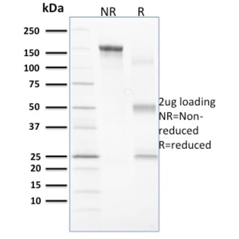 SDS-PAGE - Anti-Vinculin Antibody [VCL/2573] (A250289) - Antibodies.com