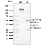 SDS-PAGE - Anti-Vinculin Antibody [VCL/2573] (A250289) - Antibodies.com