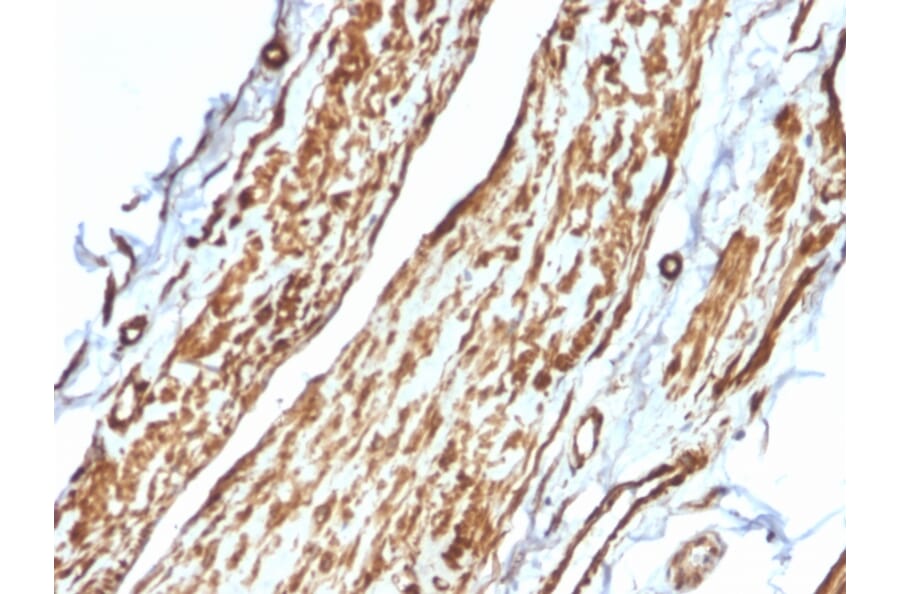 Immunohistochemistry - Anti-Vinculin Antibody [VCL/2575] (A250290) - Antibodies.com