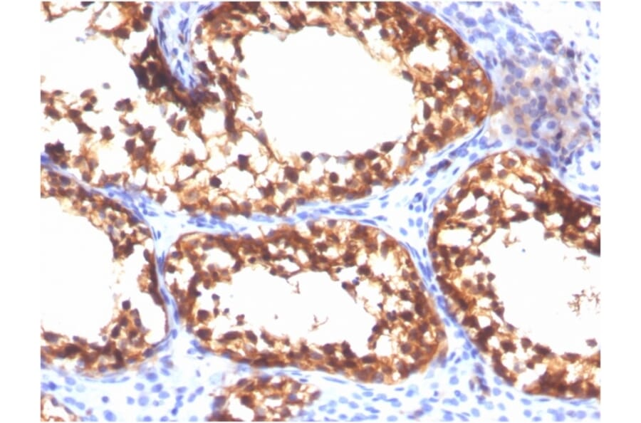 Immunohistochemistry - Anti-Vinculin Antibody [VCL/3617] (A250291) - Antibodies.com