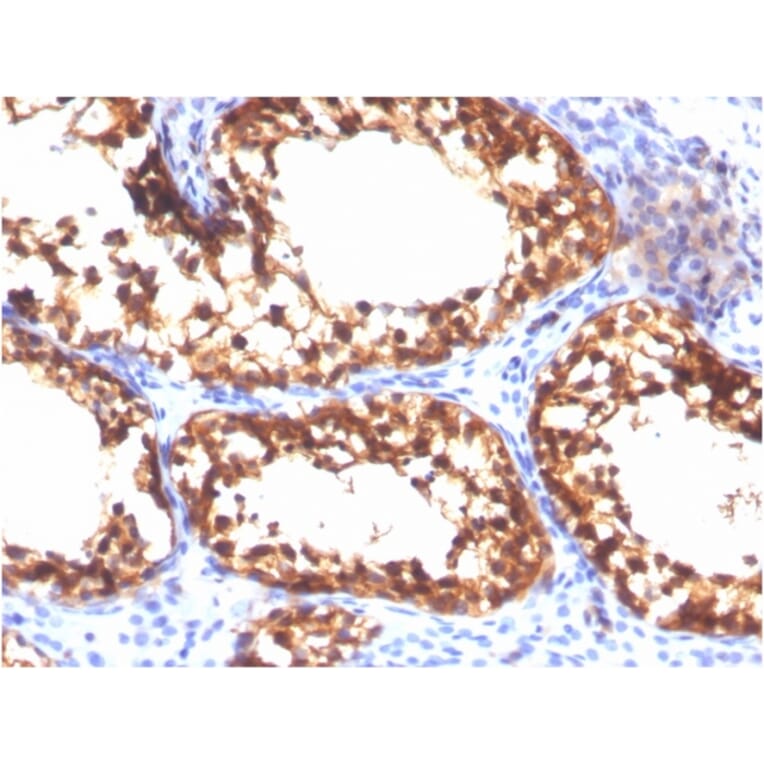 Immunohistochemistry - Anti-Vinculin Antibody [VCL/3617] (A250291) - Antibodies.com