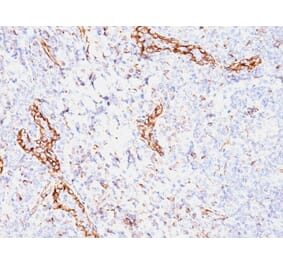 Immunohistochemistry - Anti-VEGF Antibody [VEGF/1063] (A250292) - Antibodies.com