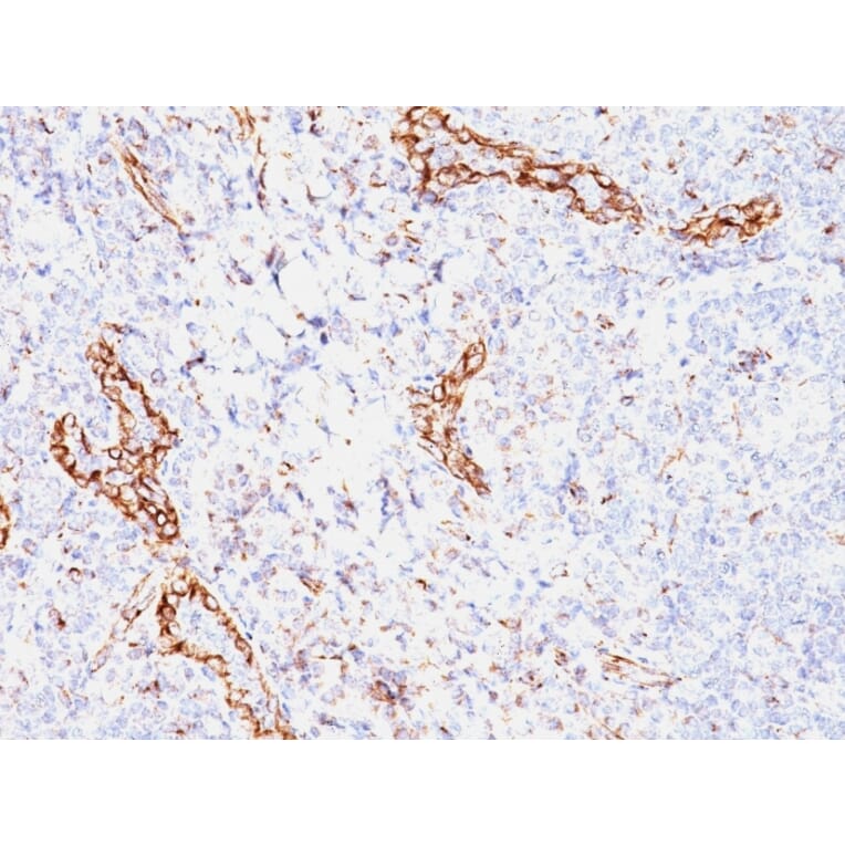 Immunohistochemistry - Anti-VEGF Antibody [VEGF/1063] (A250292) - Antibodies.com