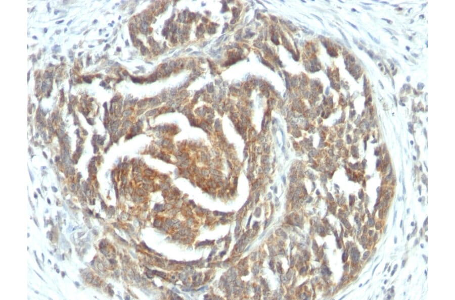 Immunohistochemistry - Anti-VEGF Antibody [VEGF/1063] (A250291) - Antibodies.com