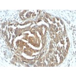 Immunohistochemistry - Anti-VEGF Antibody [VEGF/1063] (A250291) - Antibodies.com