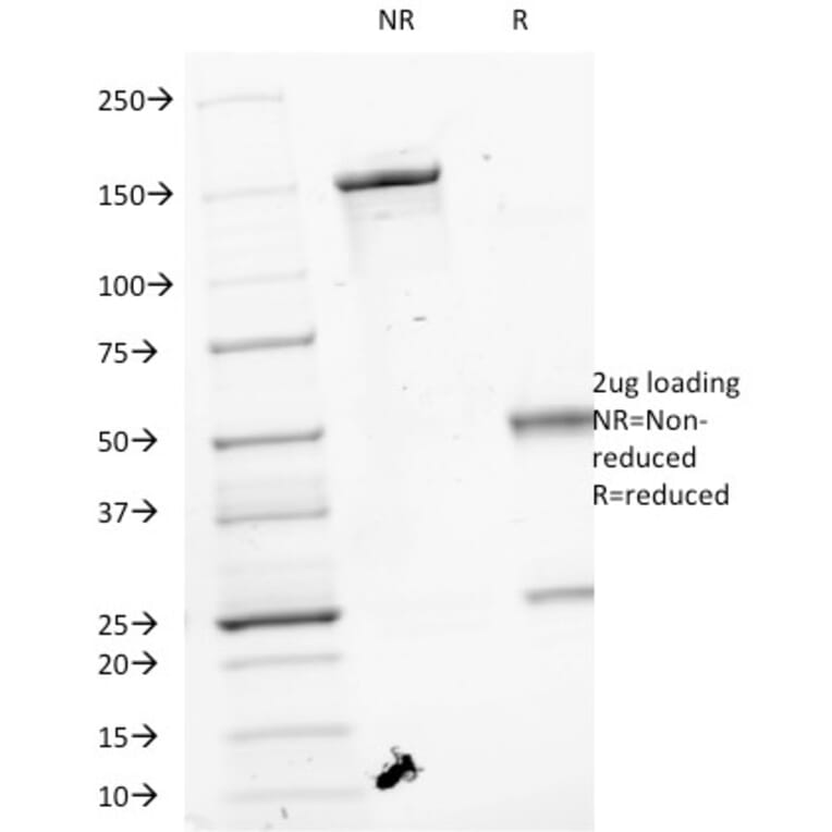SDS-PAGE - Anti-VEGF Antibody [VEGF/1063] (A250292) - Antibodies.com