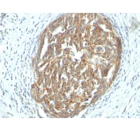 Immunohistochemistry - Anti-VEGF Antibody [SPM225] (A250292) - Antibodies.com