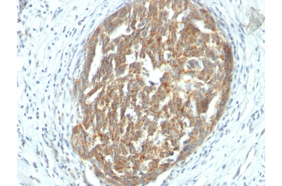 Immunohistochemistry - Anti-VEGF Antibody [SPM225] (A250292) - Antibodies.com