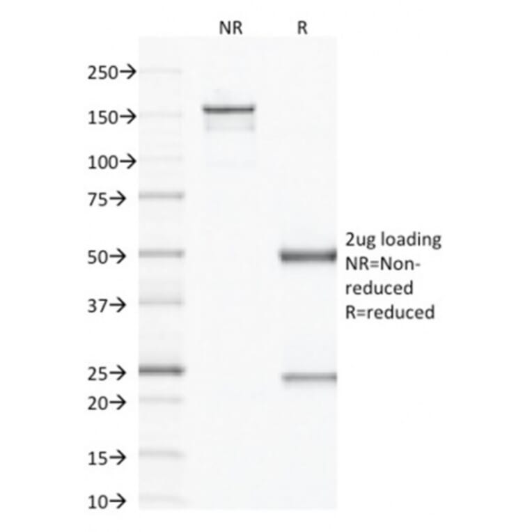 SDS-PAGE - Anti-VEGF Antibody [VG1] (A250294) - Antibodies.com