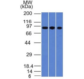 Western Blot - Anti-Villin Antibody [VIL1/1314] (A250296) - Antibodies.com