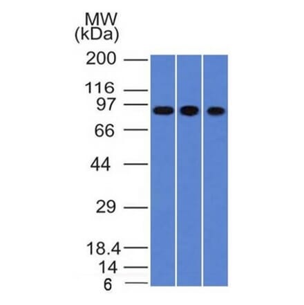 Western Blot - Anti-Villin Antibody [VIL1/1314] (A250296) - Antibodies.com