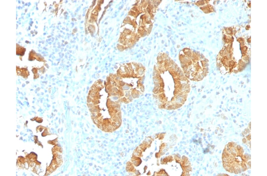 Immunohistochemistry - Anti-Villin Antibody [VIL1/1314] (A250296) - Antibodies.com