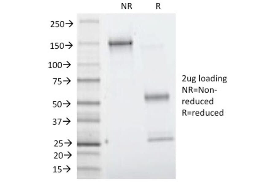 SDS-PAGE - Anti-Villin Antibody [VIL1/1314] (A250296) - Antibodies.com