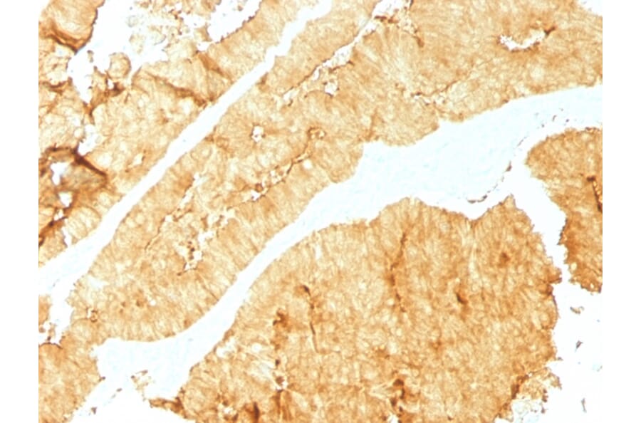 Immunohistochemistry - Anti-Villin Antibody [VIL1/1325] (A250296) - Antibodies.com