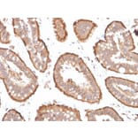 Immunohistochemistry - Anti-Villin Antibody [VIL1/1314 + VIL1/2376] (A250298) - Antibodies.com