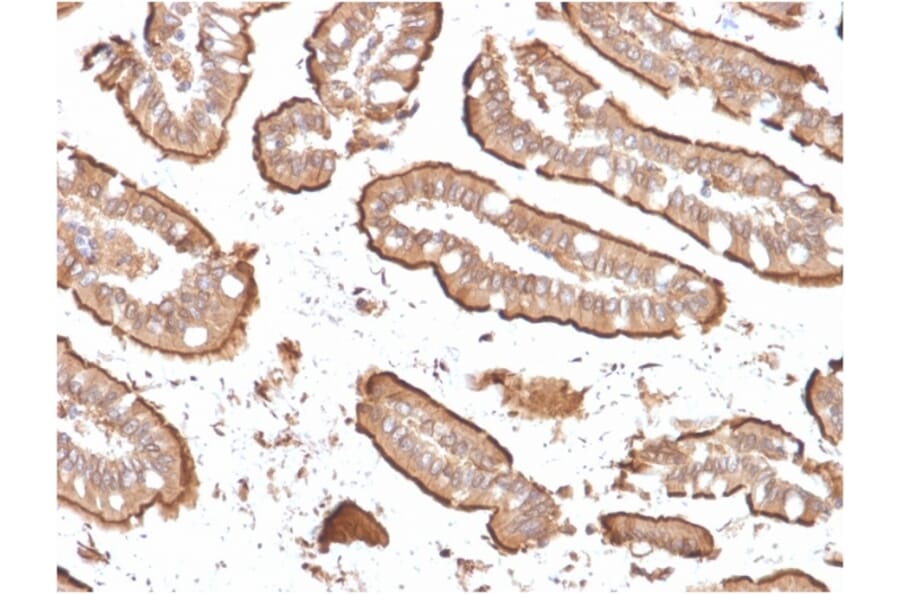 Immunohistochemistry - Anti-Villin Antibody [rVIL1/1325] (A250299) - Antibodies.com