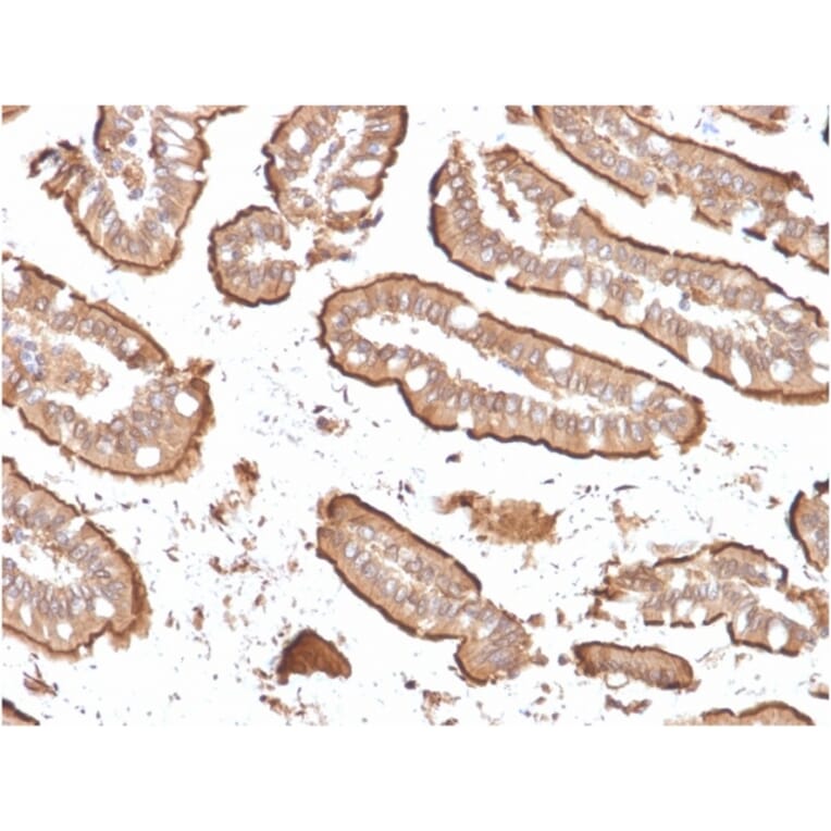 Immunohistochemistry - Anti-Villin Antibody [rVIL1/1325] (A250299) - Antibodies.com