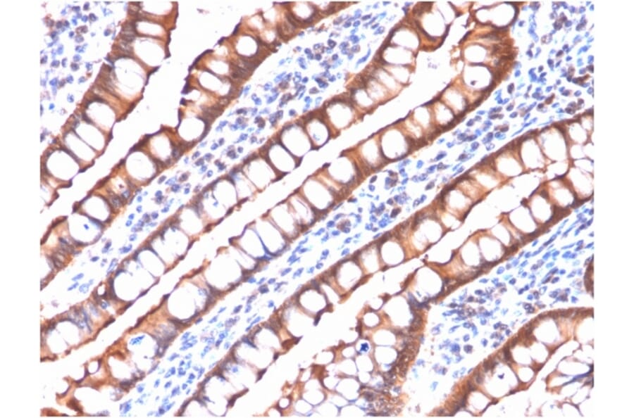 Immunohistochemistry - Anti-Villin Antibody [rVIL1/1325] (A250298) - Antibodies.com