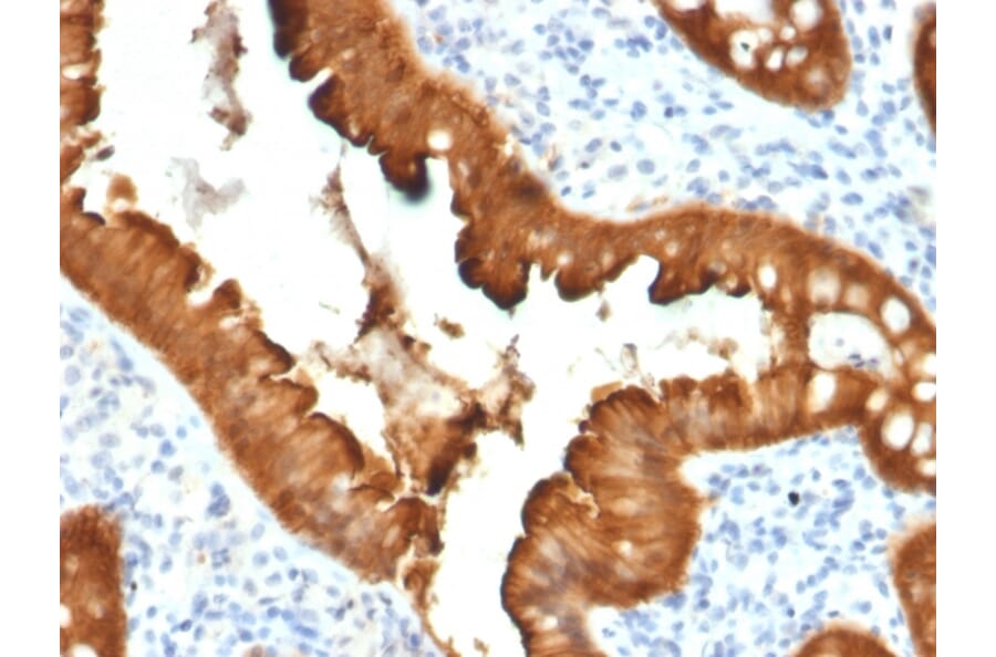 Immunohistochemistry - Anti-Villin Antibody [VIL1/2376] (A250299) - Antibodies.com