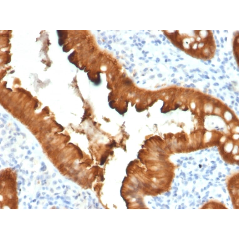 Immunohistochemistry - Anti-Villin Antibody [VIL1/2376] (A250299) - Antibodies.com