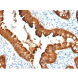 Immunohistochemistry - Anti-Villin Antibody [VIL1/2376] (A250299) - Antibodies.com