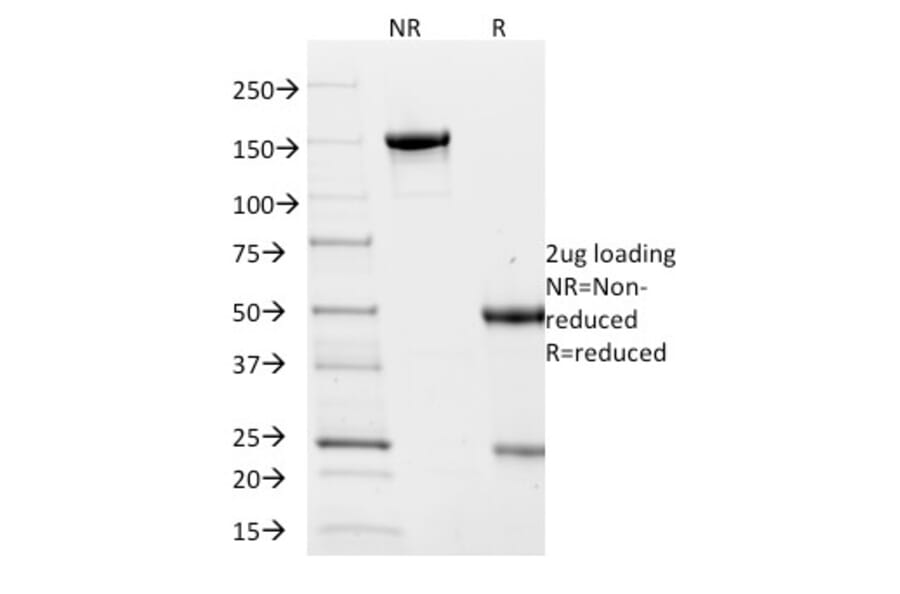 SDS-PAGE - Anti-Villin Antibody [VIL1/2376] (A250300) - Antibodies.com