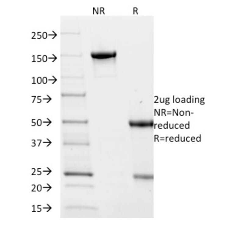 SDS-PAGE - Anti-Villin Antibody [VIL1/2376] (A250300) - Antibodies.com