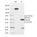 SDS-PAGE - Anti-Villin Antibody [VIL1/2376] (A250300) - Antibodies.com