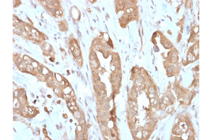 Immunohistochemistry - Anti-Villin Antibody [VIL1/2310R] (A250300) - Antibodies.com