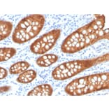 Immunohistochemistry - Anti-Villin Antibody [VIL1/4107R] (A250302) - Antibodies.com