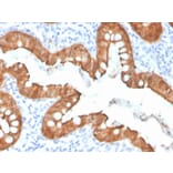 Immunohistochemistry - Anti-Villin Antibody [VIL1/4107R] (A250301) - Antibodies.com