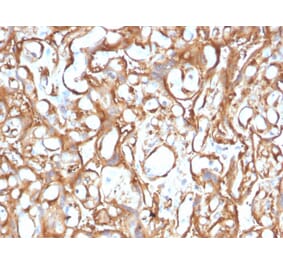 Immunohistochemistry - Anti-Ezrin Antibody [CPTC-Ezrin-1] (A250303) - Antibodies.com