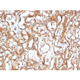 Immunohistochemistry - Anti-Ezrin Antibody [CPTC-Ezrin-1] (A250303) - Antibodies.com