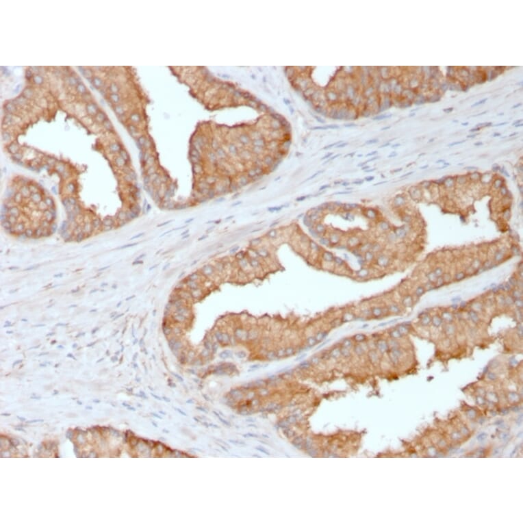 Immunohistochemistry - Anti-Ezrin Antibody [CPTC-Ezrin-1] (A250303) - Antibodies.com