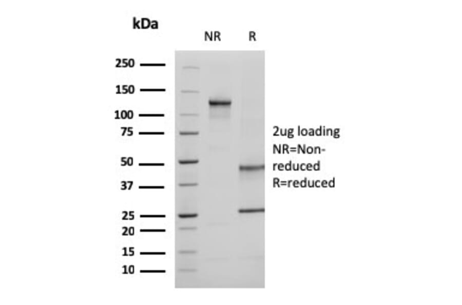 SDS-PAGE - Anti-Ezrin Antibody [CPTC-Ezrin-1] (A250303) - Antibodies.com