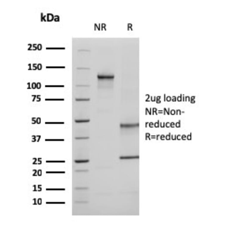 SDS-PAGE - Anti-Ezrin Antibody [CPTC-Ezrin-1] (A250303) - Antibodies.com