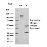 SDS-PAGE - Anti-Ezrin Antibody [CPTC-Ezrin-1] (A250303) - Antibodies.com