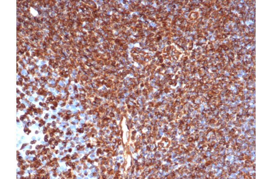 Immunohistochemistry - Anti-Vimentin Antibody [rVIM/6431] (A250305) - Antibodies.com
