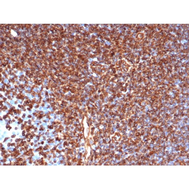 Immunohistochemistry - Anti-Vimentin Antibody [rVIM/6431] (A250305) - Antibodies.com