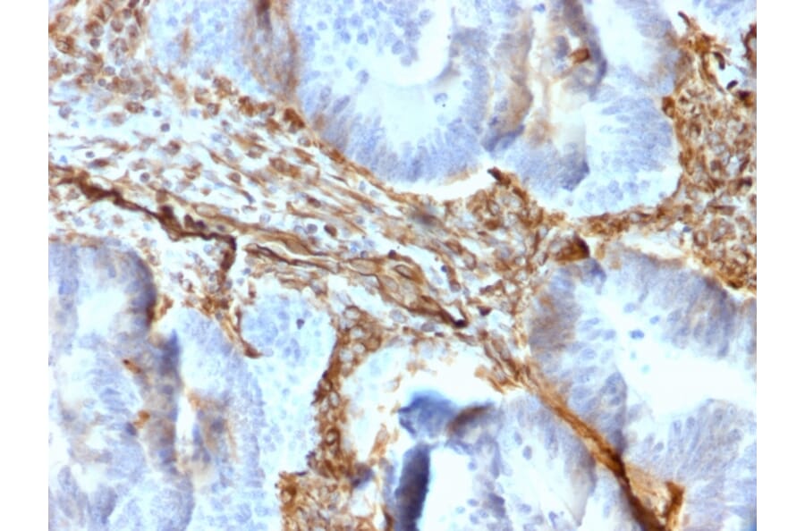 Immunohistochemistry - Anti-Vimentin Antibody [rVIM/6431] (A250304) - Antibodies.com