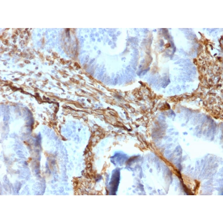 Immunohistochemistry - Anti-Vimentin Antibody [rVIM/6431] (A250304) - Antibodies.com